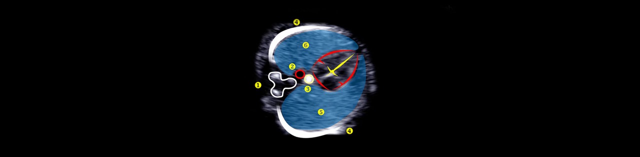 Essential Echocardiography