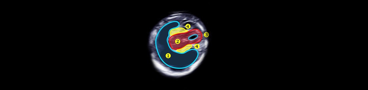 Early Neurosonography Masterclass