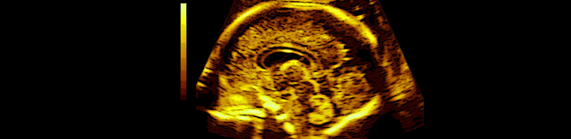 Fetal Neurosonography (Virtual Edition 2021)