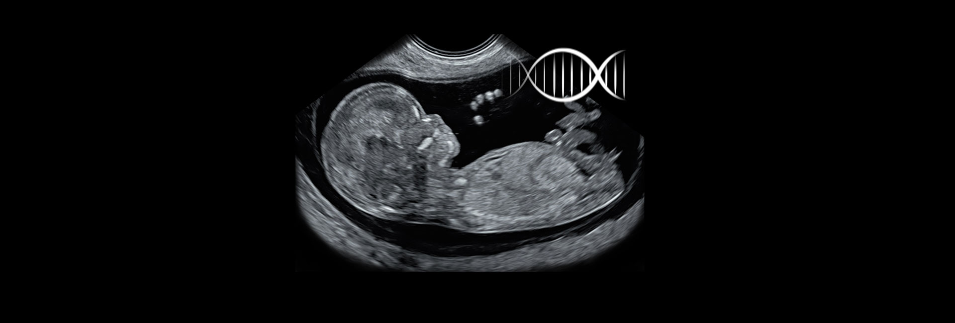 Early Fetal Test at 12 Weeks – recording