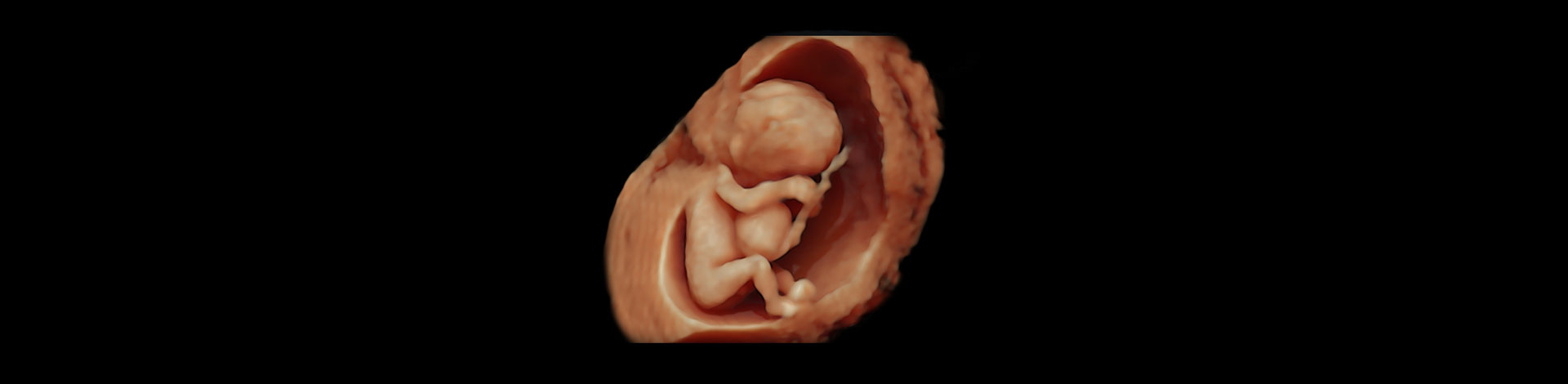 How to Scan Fetus with Anomaly – recording