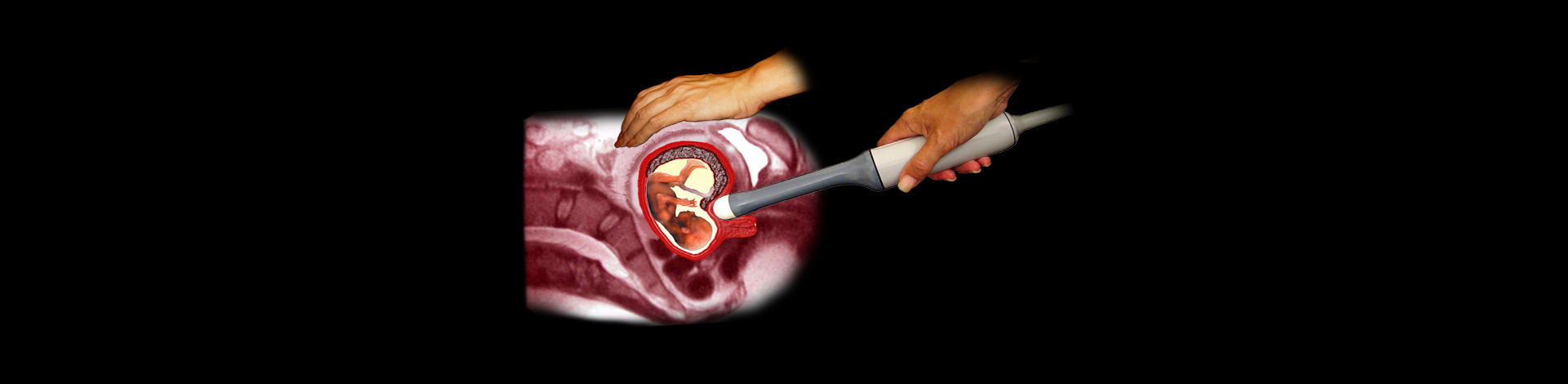 Expert Early Fetal Scan at 11-13 Weeks: Live Demo Recording